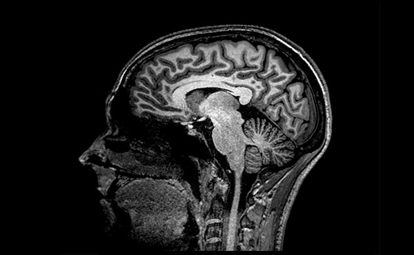 Neuroimaging Research Group BBRC