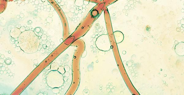 Grup de Recerca de Biomarcadors de Fluids i Neurologia Traslacional