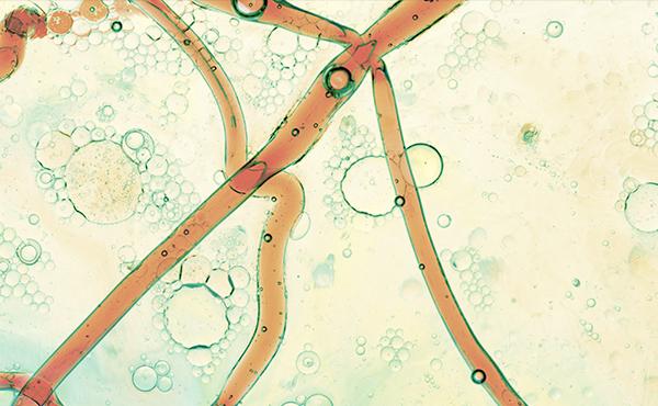 Fluid Biomarkers and Translational Neurology