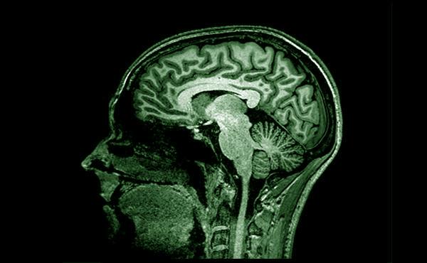 Neuroimaging Research Group BBRC