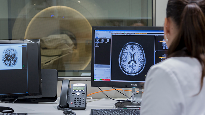 El proyecto investigará como la menopausia afecta a la salud cerebral Imagen de resonancia magnética de un participante ALFA