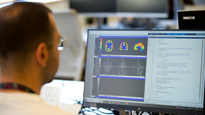 Investigador analizando imagen PET