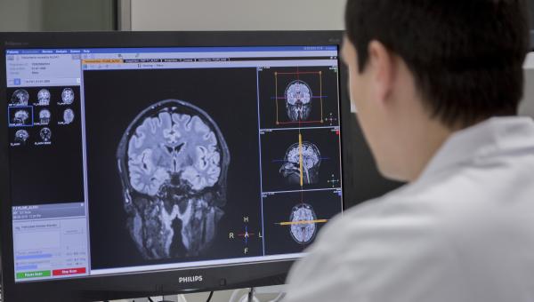 Los portadores del gen de APOE ε2 pueden tener una mayor reserva cerebral y mejor protección contra el Alzheimer