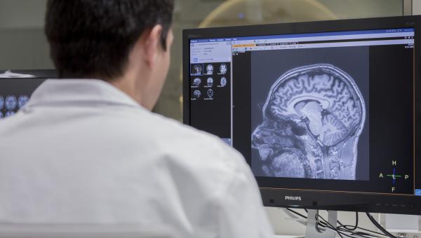 The results of the study show the value of regional amyloid PET analysis to detect cognitive impairment in people who carry the APOE-ε4 gene 