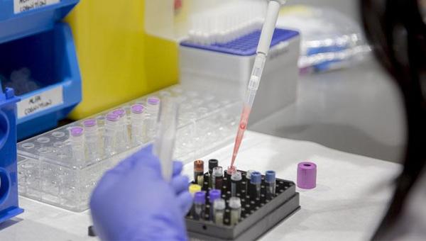 Edad biológica y Alzheimer