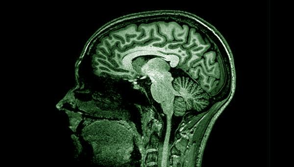 Neuroimaging group