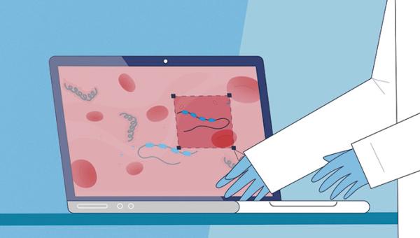 El objetivo de Alfa es identificar las características fisiopatológicas tempranas de la enfermedad de Alzheimer para poder detectarla de forma precoz y diseñar programas de prevención que retrasen o detengan la aparición de los síntomas.