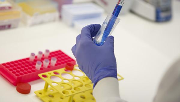 New therapies are needed to prevent or delay the onset of symptoms, slow disease progression or improve the cognitive and behavioral symptoms of Alzheimer's disease.