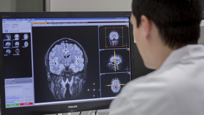 Els portadors del gen d’APOE ε2 poden tenir una reserva cerebral més gran i millor protecció contra l’Alzheimer
