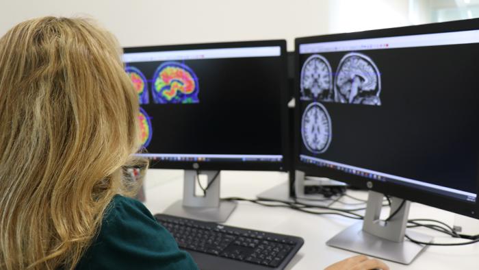 Gràcies a aquesta tècnica de neuroimatge es poden detectar i avaluar els dipòsits de la proteïna beta amiloide associats a la malaltia d’Alzheimer en el cervell.