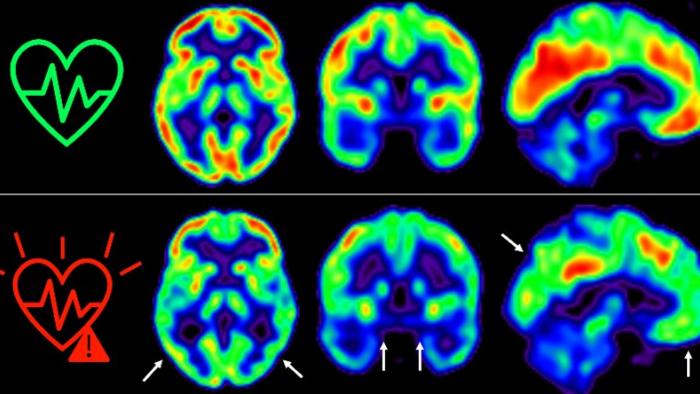 The Lancet Healthy Longevity